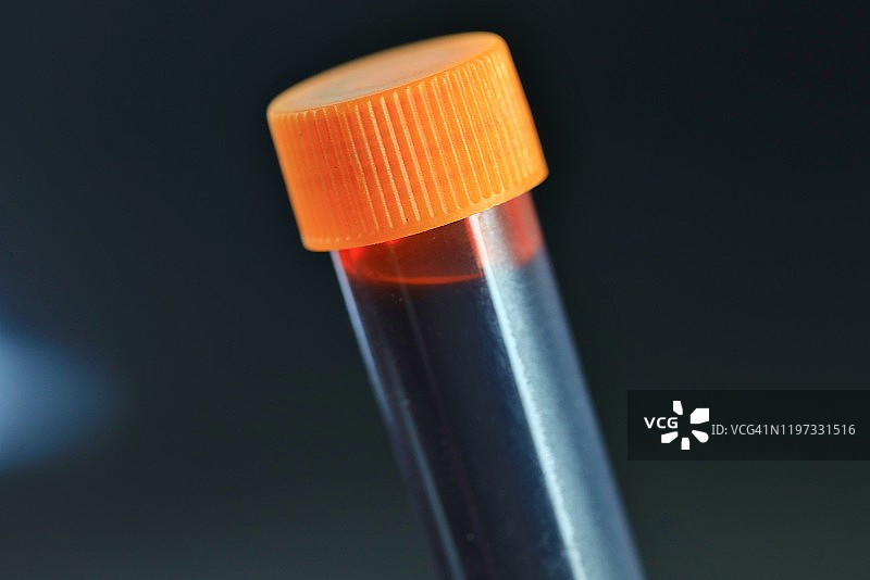 血液样本检测图片素材