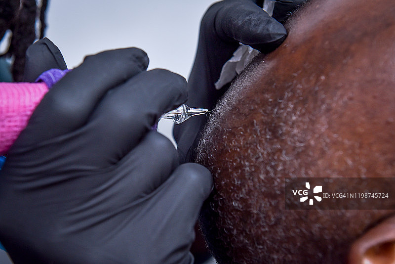 非洲裔秃头男性头皮微色素沉着图片素材