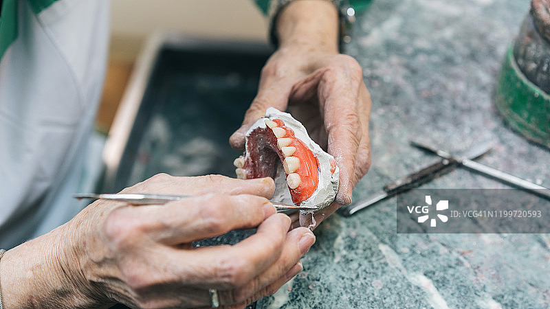 牙科修复体、假牙图片素材