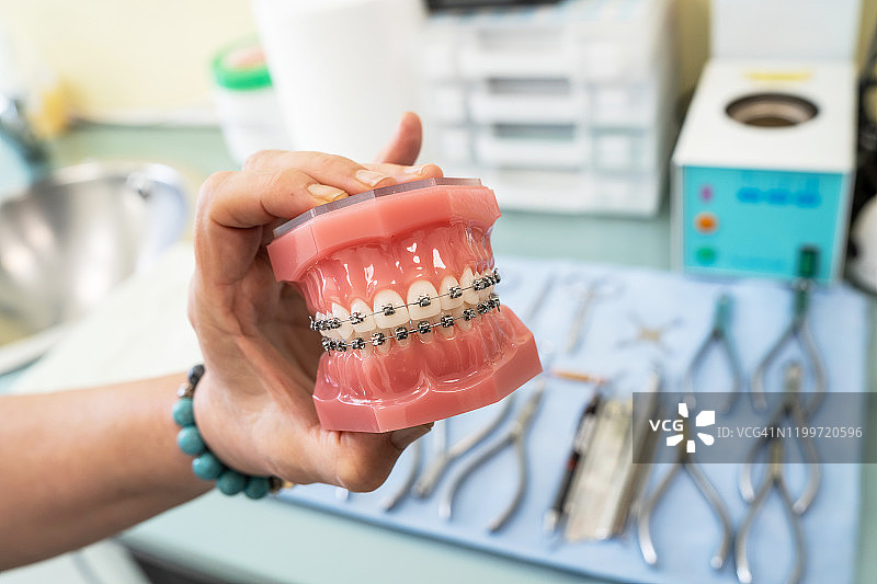 牙齿正畸模型图片素材