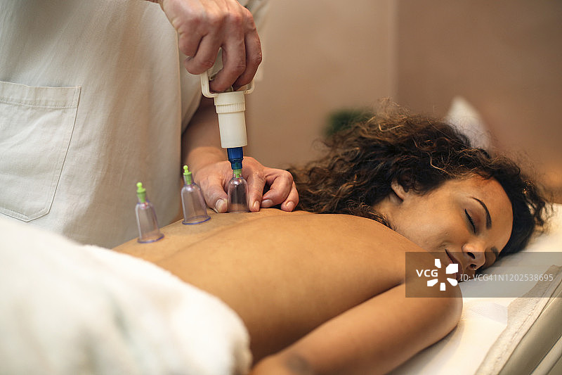 真空拔罐疗法图片素材