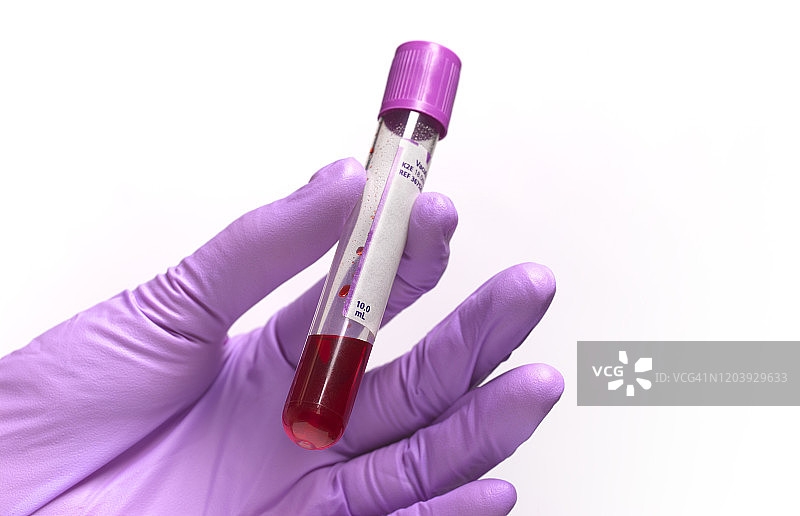 手持装有血液的试管图片素材