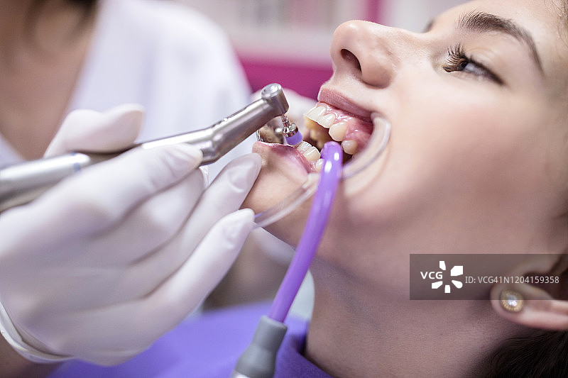 女孩进行牙齿抛光图片素材