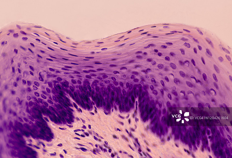 食道复层鳞状上皮，100倍图片素材