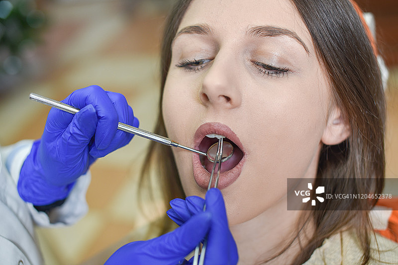 牙医补牙特写图片素材