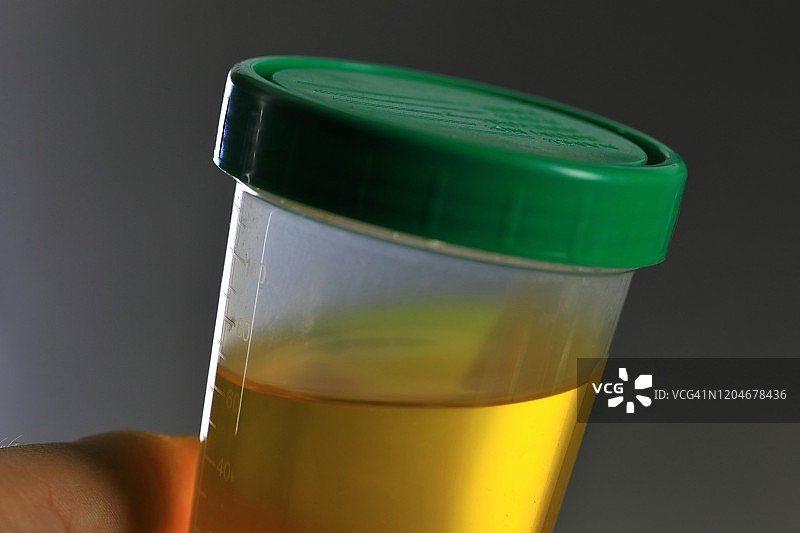 用于药物测试的尿液样本瓶图片素材