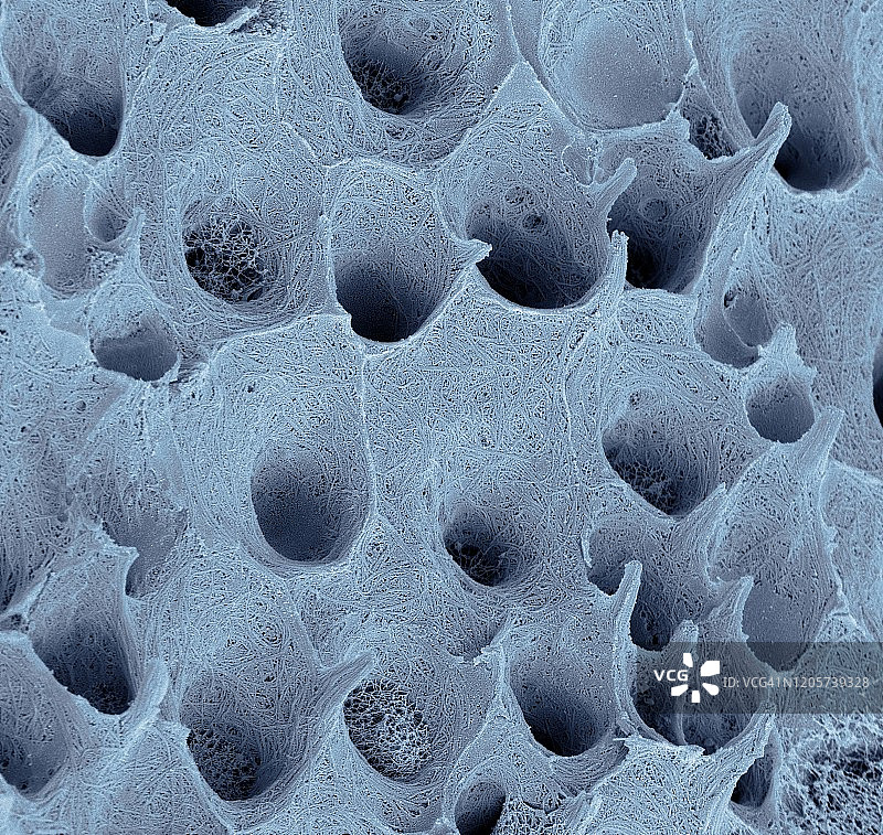 牙齿牙本质扫描电镜图图片素材