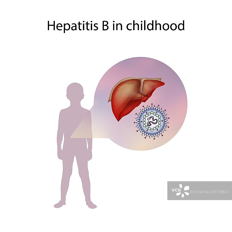 儿童乙型肝炎插画图片素材