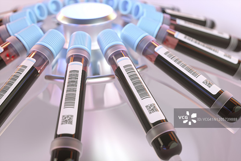 血液样本离心过程示意图图片素材