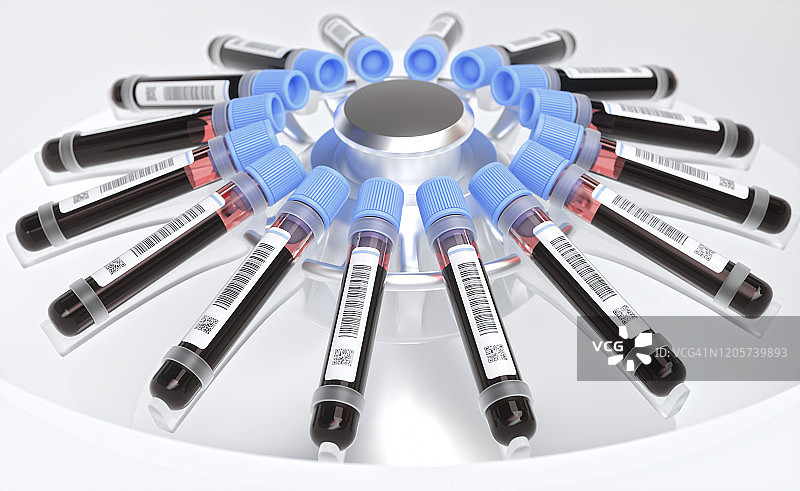 血液样本离心过程示意图图片素材