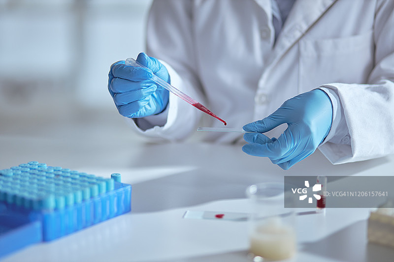 更好地了解病毒图片素材