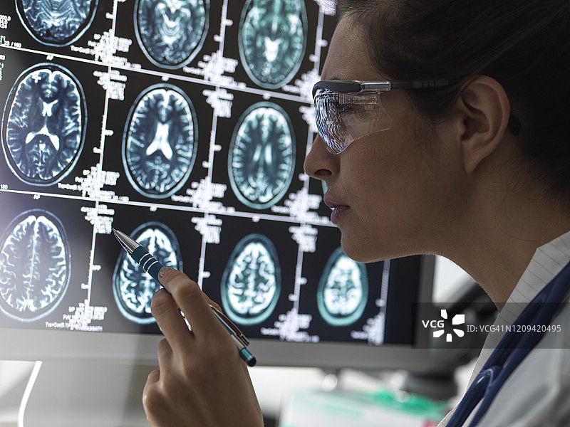 神经科诊断：女医生分析人脑扫描图片素材