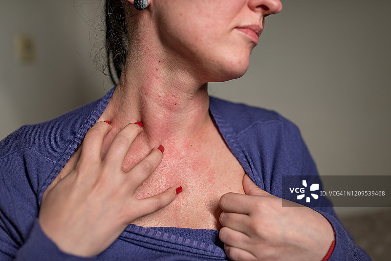 女人用手挠痒图片素材