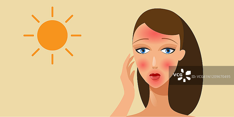 晒后皮肤发红的女人图片素材