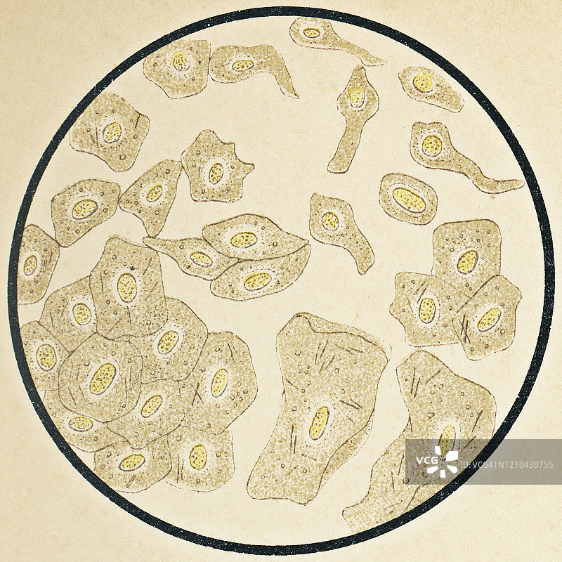来自尿道和膀胱的人类鳞状上皮细胞的微观视图 - 19世纪图片素材