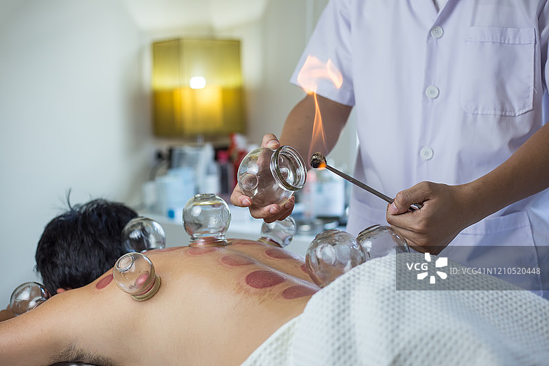 传统中医治疗——针灸图片素材