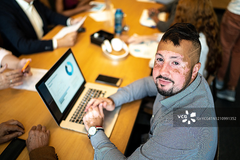 在会议室里患有白癜风的商人图片素材