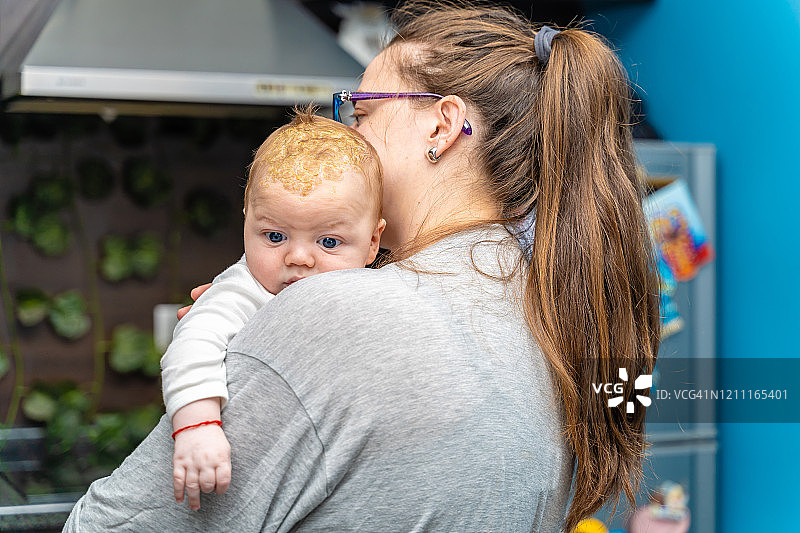 妈妈抱着有乳痂的婴儿头部图片素材