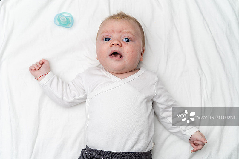 患有脂溢性皮炎的可爱男婴图片素材