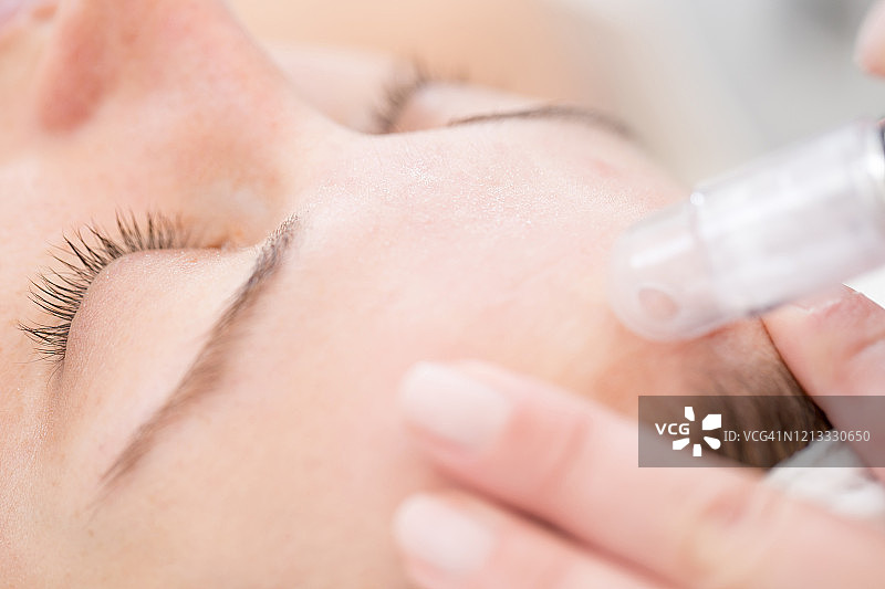 成人女性额头微晶磨皮特写图片素材