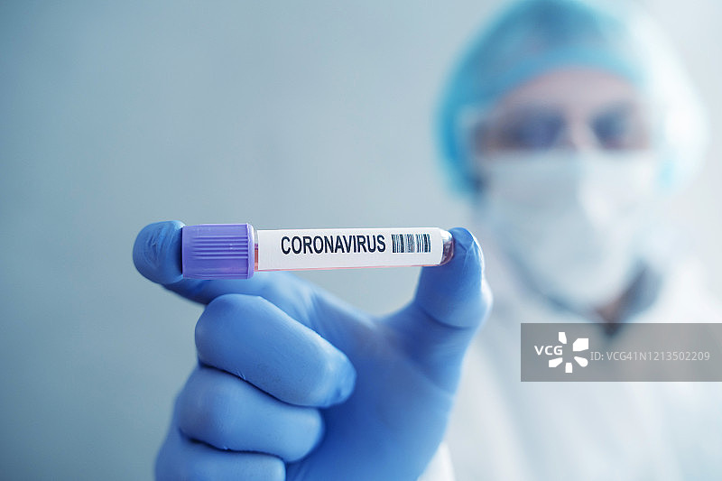 医院实验室中的新冠病毒血液检测图片素材