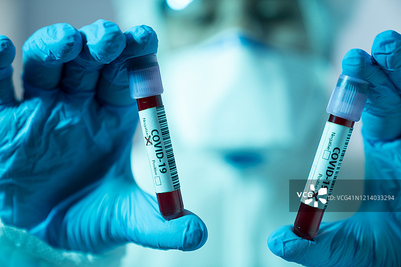带有新冠病毒标签的血液样本试管图片素材