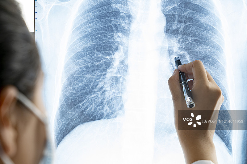 医生在病房检查新型冠状病毒患者的胸部X光片图片素材