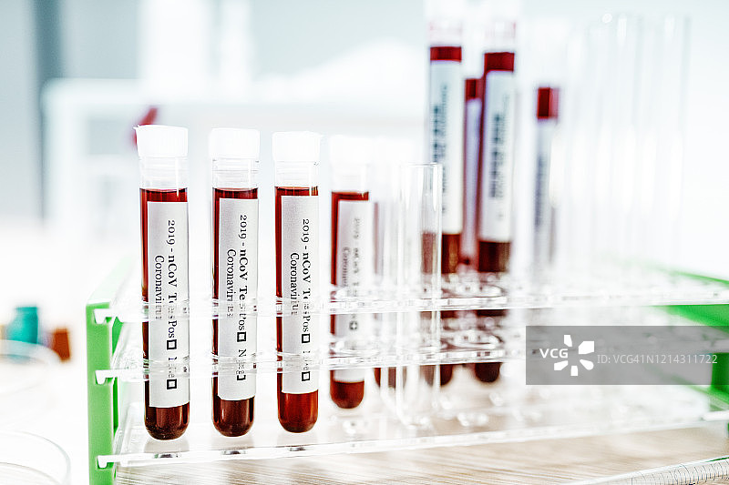 实验室中带有2019-nCoV的试管图片素材