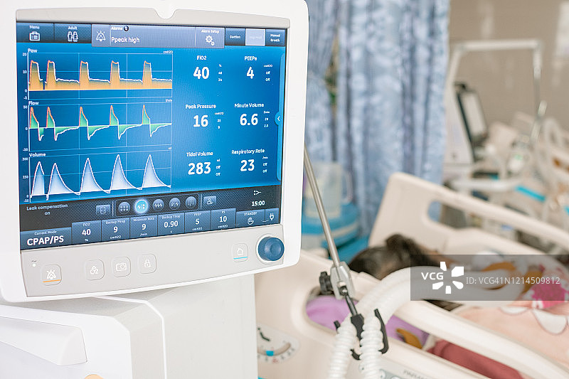 呼吸机监视器，通过插管向患者供氧，ICU/急诊室设置图片素材