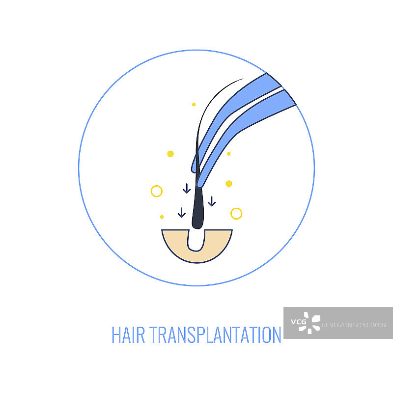 植发程序图示图片素材