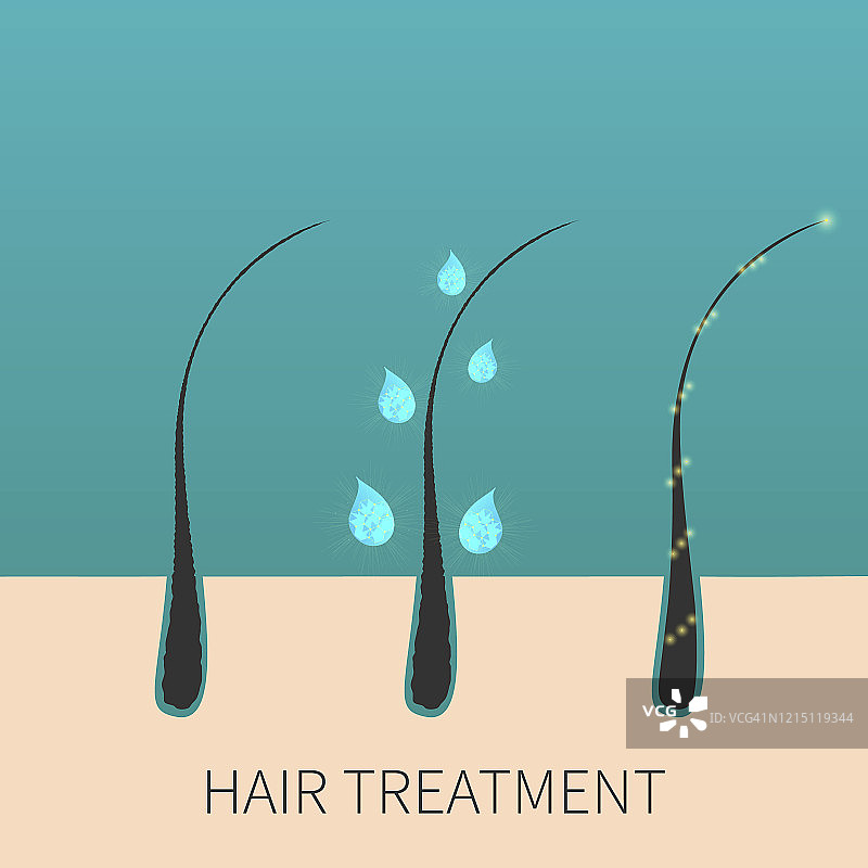 治疗后的毛囊插图图片素材