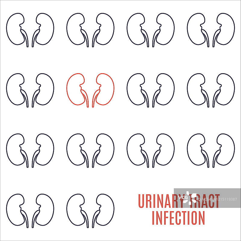 泌尿道感染概念图图片素材