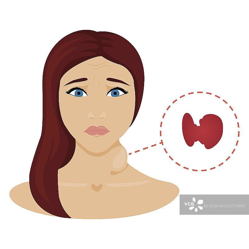 甲状腺功能亢进症的女性，插图图片素材