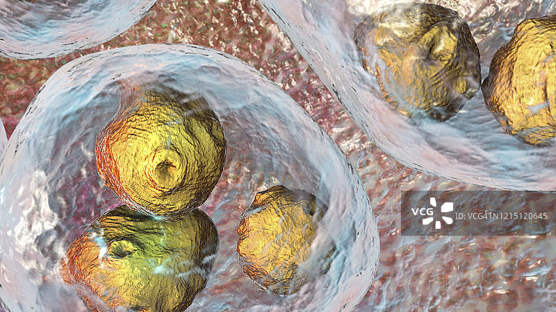 细粒棘球绦虫包虫囊肿图示图片素材