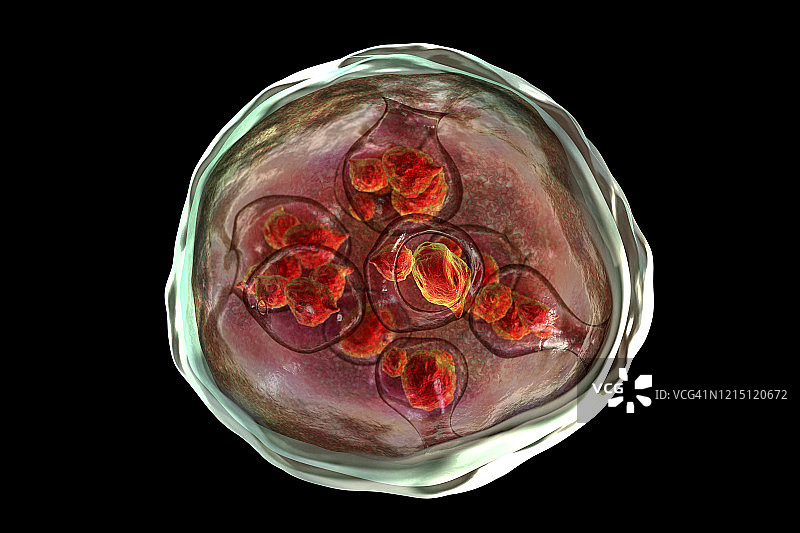 细粒棘球绦虫包虫囊肿图示图片素材