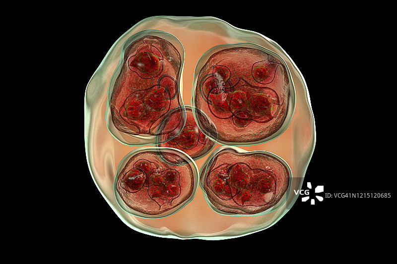 多房棘球绦虫包虫囊肿插图图片素材