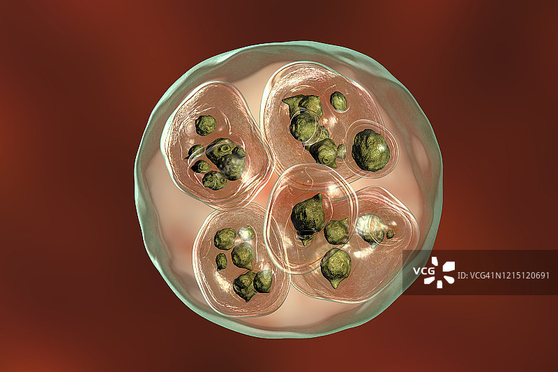 多房棘球绦虫包虫囊肿插图图片素材