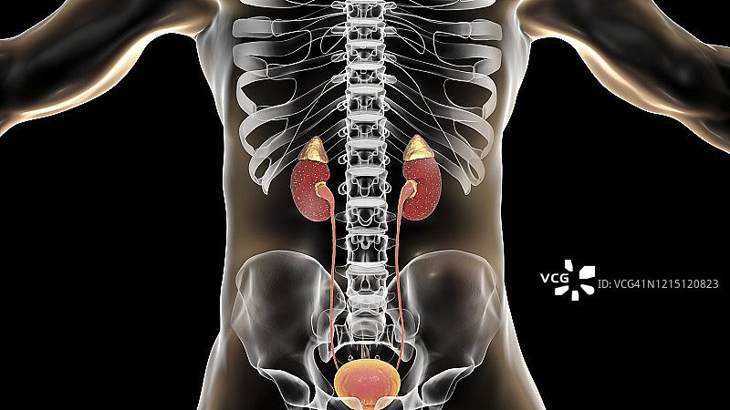 急性肾盂肾炎插图图片素材