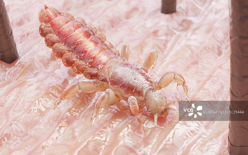 人头虱在人的头部，插图图片素材