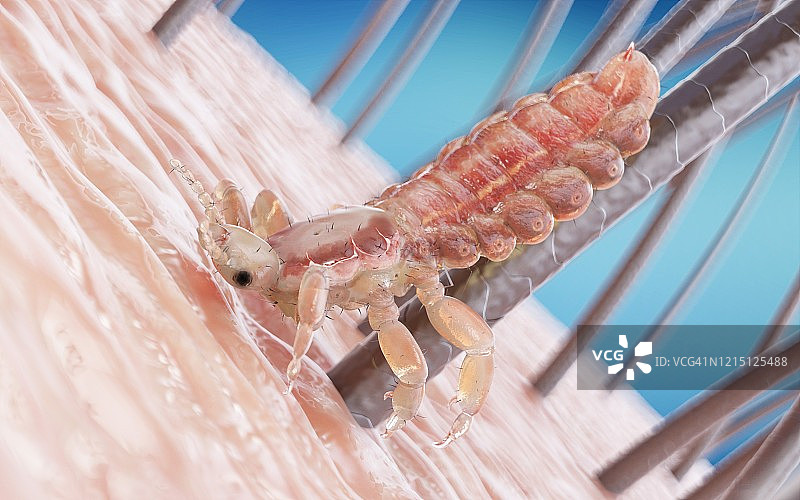 头虱插画图片素材