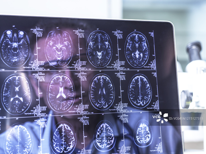 神经内科诊断概念图图片素材