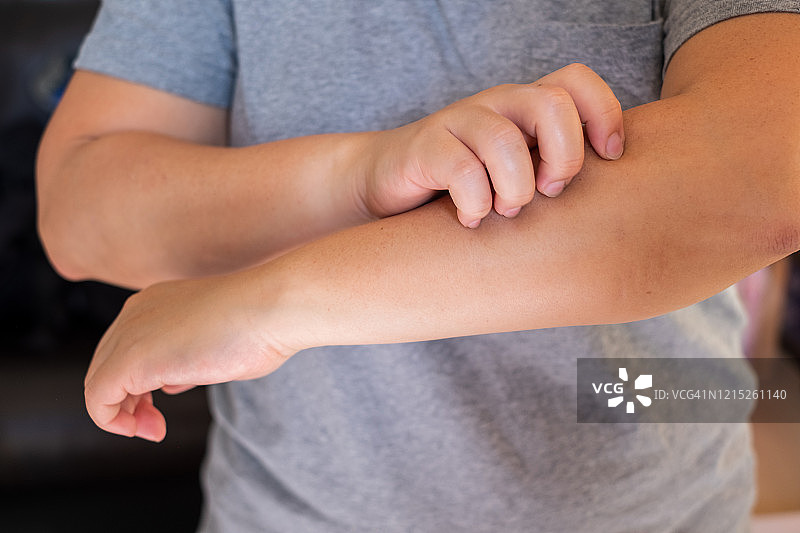 女人因皮肤过敏发痒而挠手臂图片素材