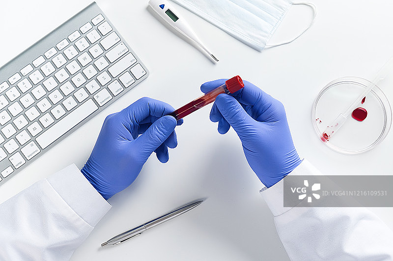 医生或实验室助理手持装有血液的试管进行医学研究图片素材