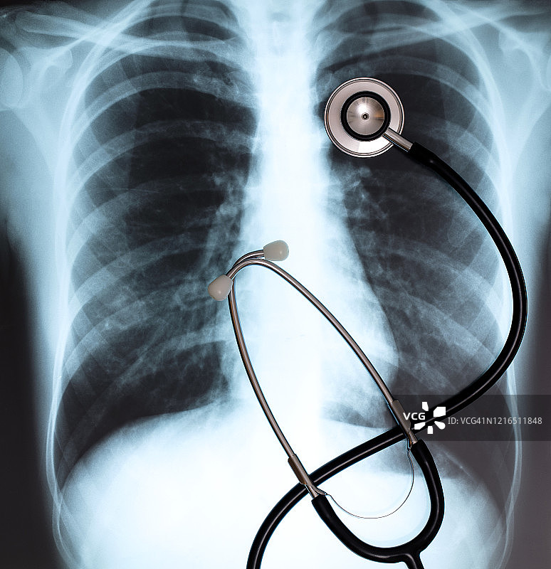 人体胸部X光片上的听诊器图片素材