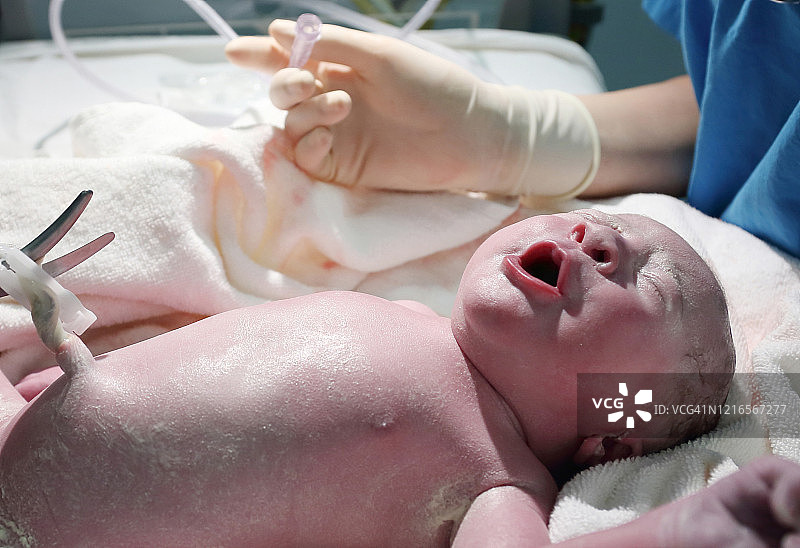 手术室里的新生婴儿图片素材