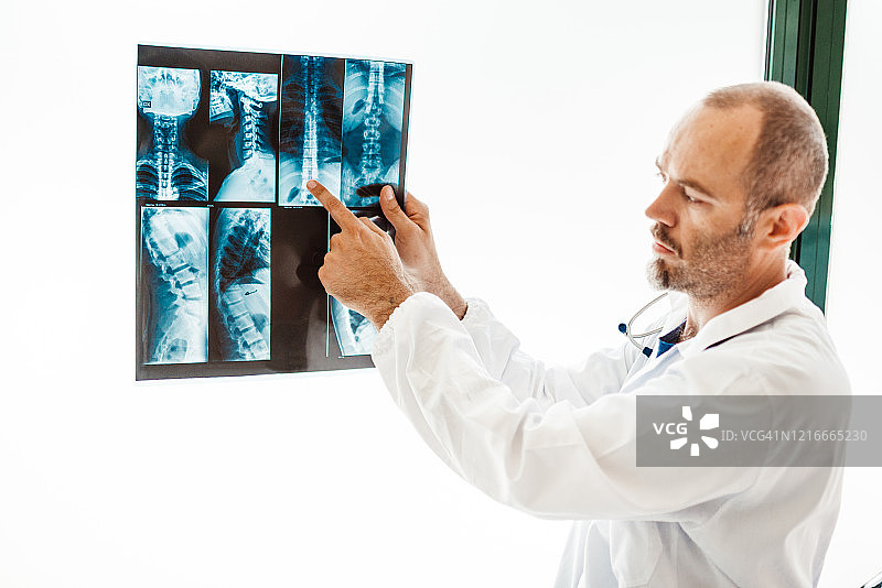 医生在医院检查肺炎X光片图片素材