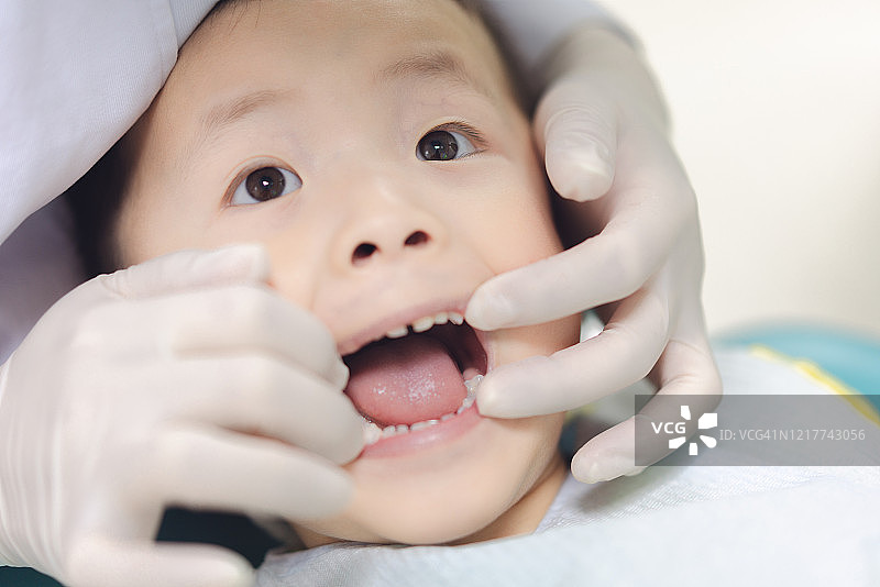 儿童接受牙科检查图片素材