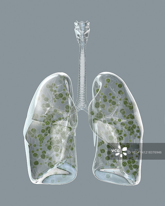 感染冠状病毒的玻璃肺图片素材