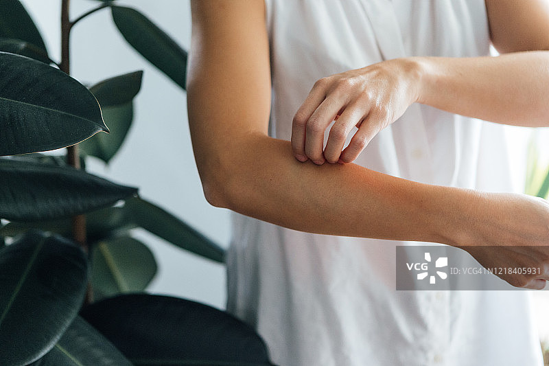 年轻女人用手指挠前臂图片素材
