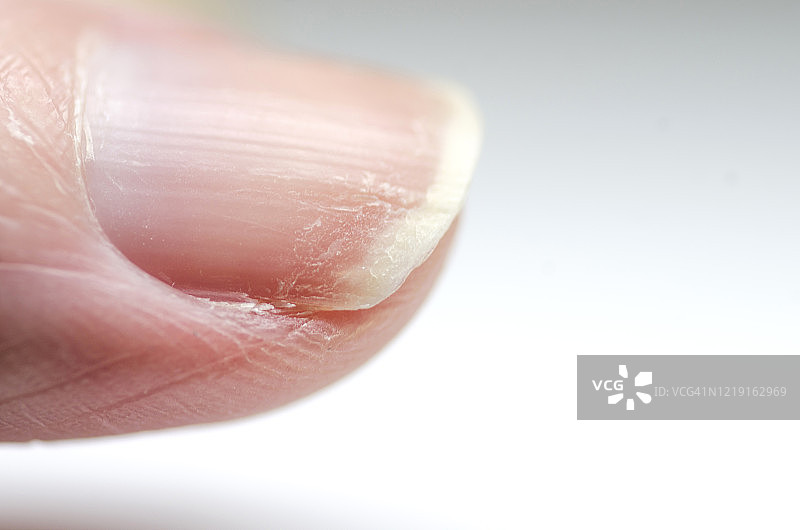 干燥的钉子图片素材